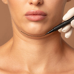Double Chin Removal